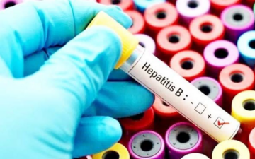 Hepatit B bulaşıcılığı